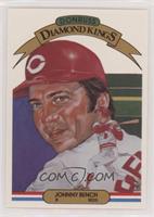 Johnny Bench