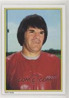 Pete Rose