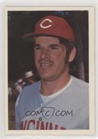 Pete Rose