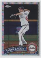 Tommy Hanson