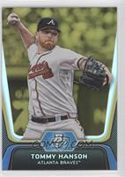 Tommy Hanson