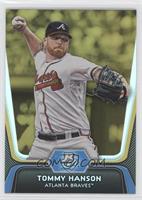 Tommy Hanson