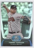 Tommy Hanson