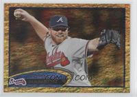 Tommy Hanson