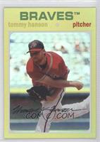 Tommy Hanson