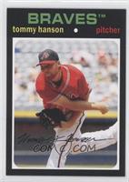 Tommy Hanson