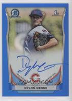 Dylan Cease #/150