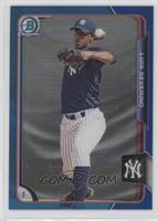 Luis Severino #/150