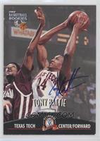 Tony Battie