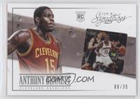 Anthony Bennett #/35