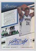 Anthony Bennett #/7