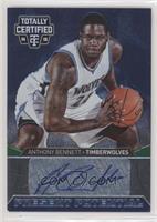 Anthony Bennett #/99