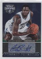 Anthony Bennett #/99