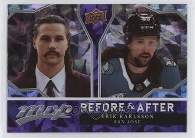 2021-22 Upper Deck MVP - Before and After #BA-6 - Erik Karlsson