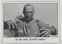 Do You Have Dishpan Hands?