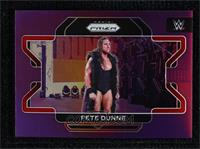 Pete Dunne #/149